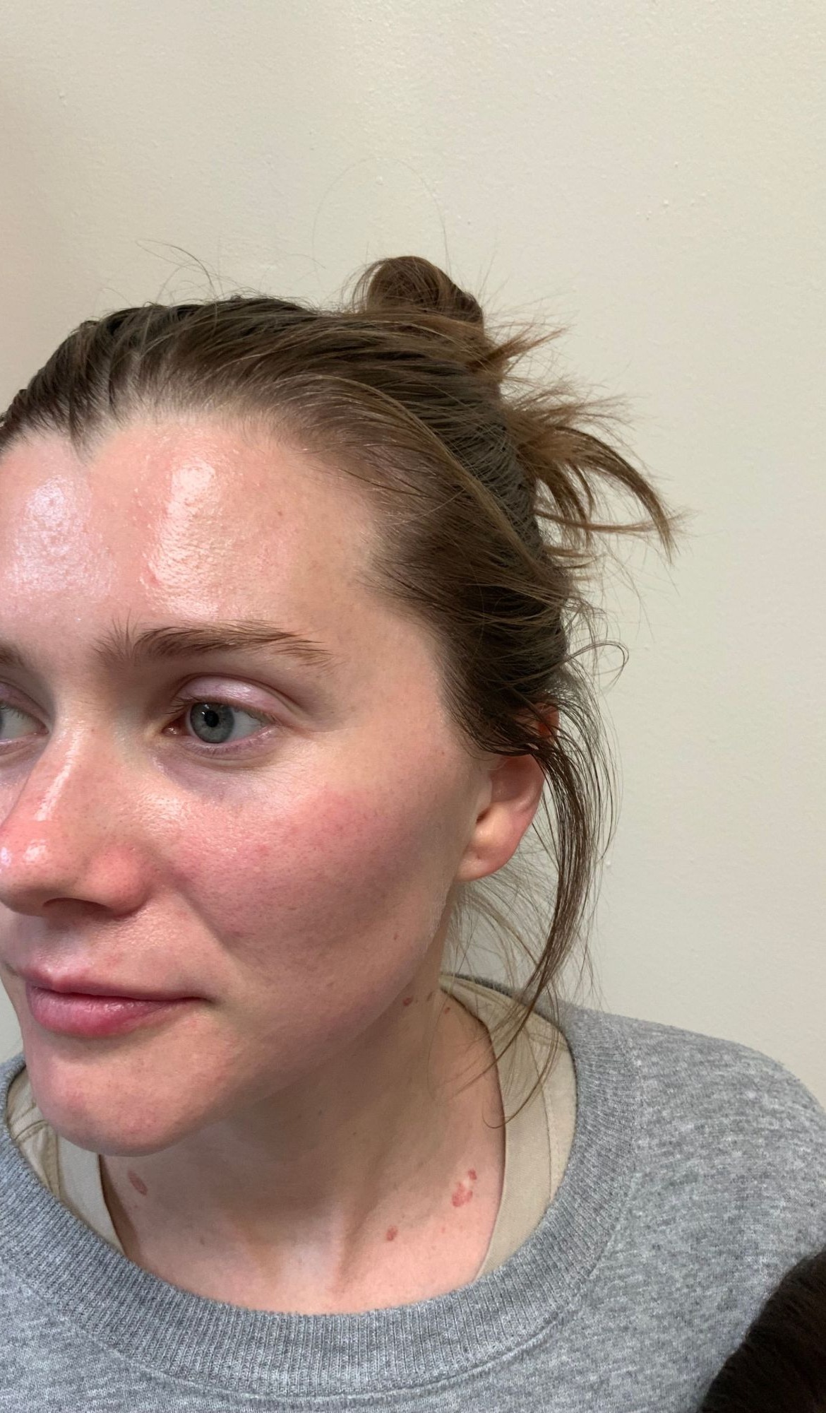 Glowing skin results at AloEver Medspa