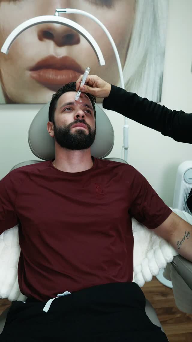 Botox injection at AloEver Medspa