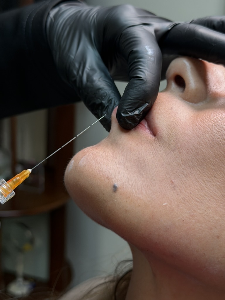 AloEver Medspa injection treatment